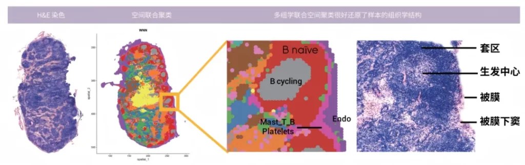 人癌旁淋巴结样本多组学联合聚类结果与组织学结构对应关系