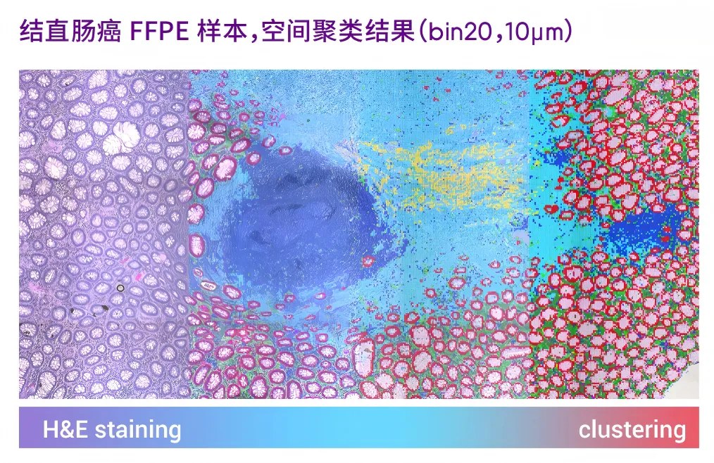 同一张 FFPE 组织切片上完成 H&E 染色并显微成像，后续用于与空间转录组数据叠加