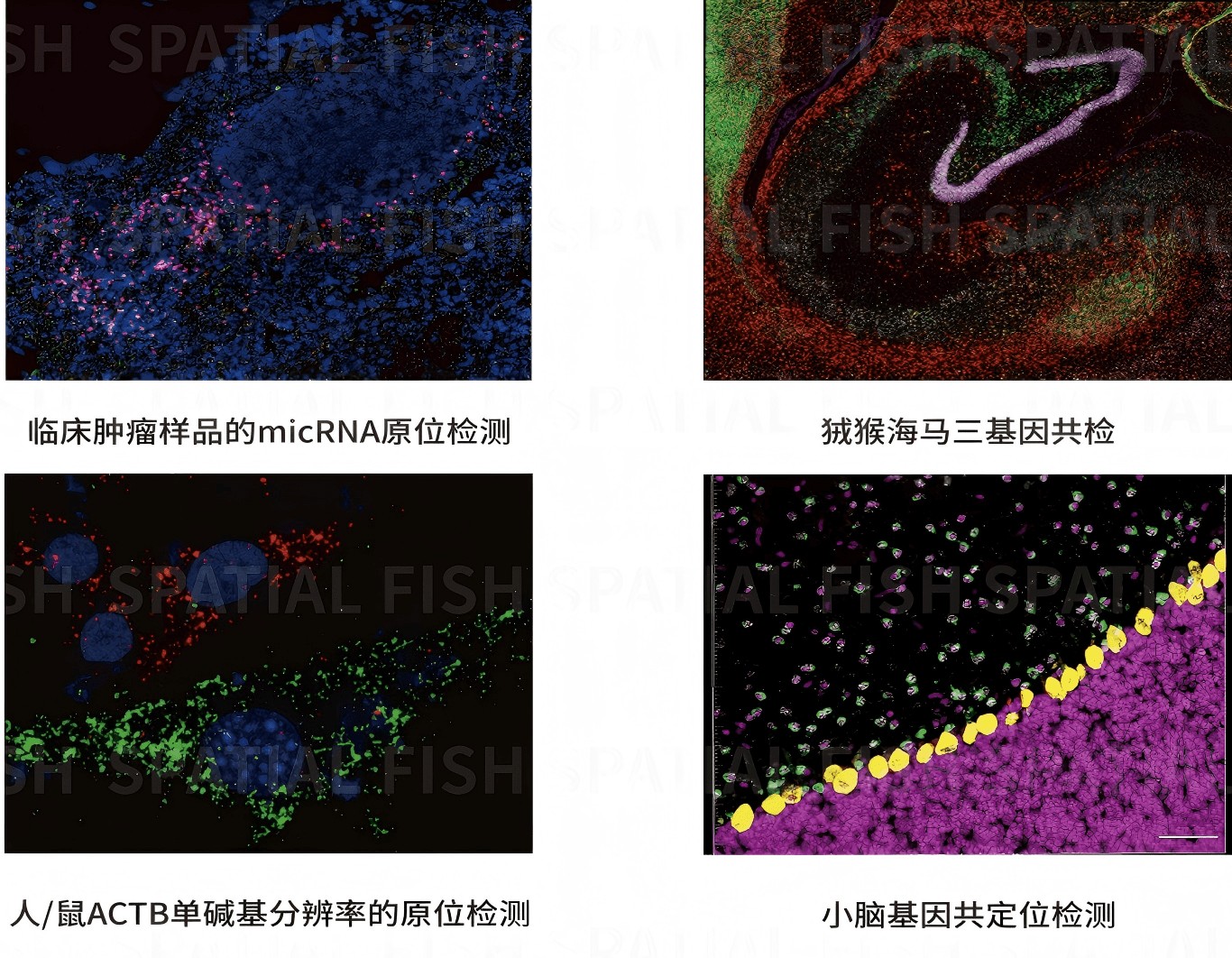 MiP-seq 原位检测与组织形态对照：信号点与细胞结构叠加