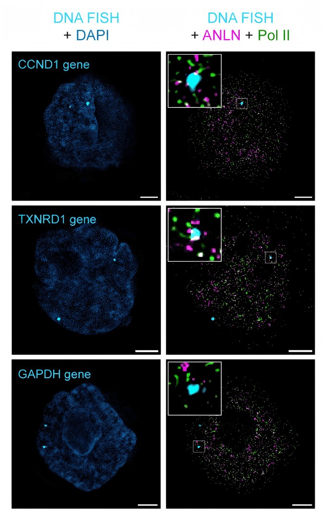 MiP-seq 验证结果：ANLN 蛋白与 CCND1、TXNRD1 靶基因位点在细胞核内的协同空间定位